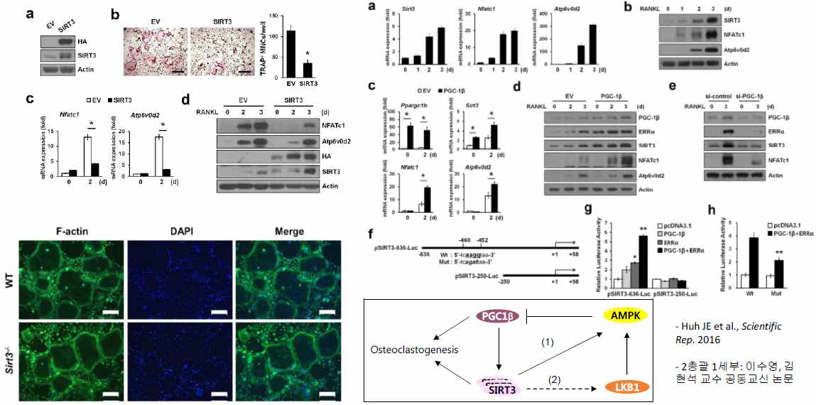 오토파지 조절단백질 Sirtuin3의 골세포항상성 신규조절 기전 규명.