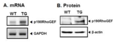 Peritoneal macrophage에서p190RhoGEF transgene expression