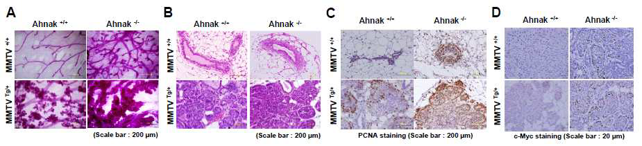 MMTV-PyVT와 Ahnak KO mice를 mating한 쥐의 mammary gland에서 tumor 생성