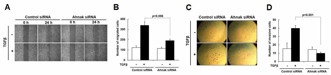 Ahnak 단백질의 의한 세포의 이동 및 침윤 억제