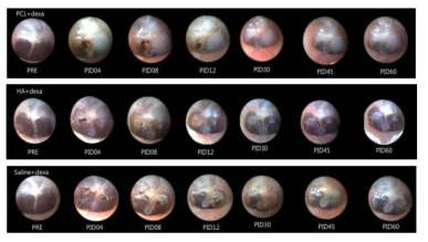 약물 고막 주입 전, 후 4, 8, 12, 30, 45, 60일째 내시경으로 촬영한 고막 사진
