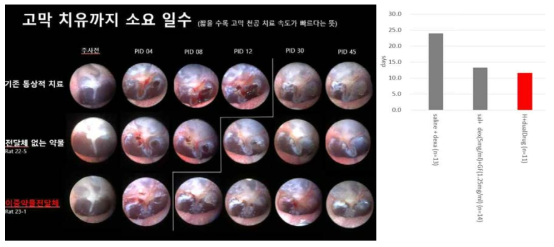 약물 고막 주입 전, 후 4, 8, 12, 30, 45일째 내시경으로 촬영한 고막 사진.