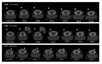 고실 내 혼합약물 주입 후 4, 8, 12, 30, 45, 60일째 촬영 한 CT.