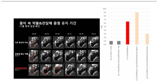 고실 내 혼합약물 주입후 4, 8, 12, 30, 45일째 촬영한 CT.