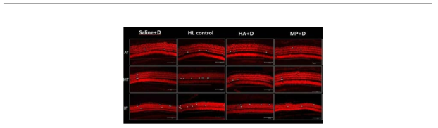 Saline+dexa, HL control, HA+dexa, MPEG+dexa 처리한 cochlea의 공초점 현미경 사진