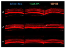 Saline+dexa, 4500kDa HA+dexa, 이중약물 주입한 cochlea의 공초점 현미경 사진
