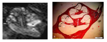 백서내이의 자기공명영상 (A)과 광학현미경을 통한 조직 이미지 (paraffin embedding and H&E staining) 비교.