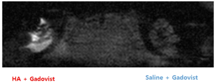 HA+Gadovist와 saline+Gadovist를 각각 고막 주입한 후 시간에 따른 외 림프액의 조영증가 패턴.