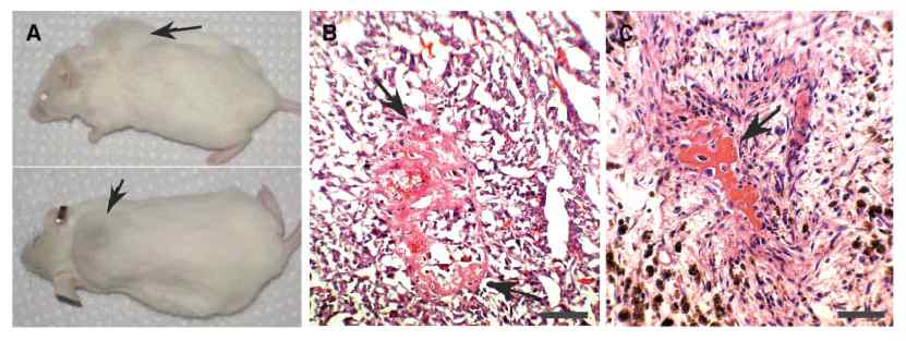줄기세포의 Xenograft (이종 이식)와 암조직의 염색
