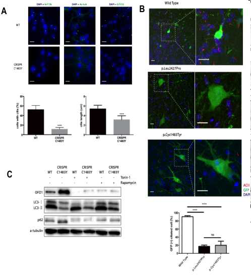 난치성 뇌전증 유발 mTOR 뇌 체성 유전 변이에 의해 autophagy-mediated ciliogenesis가 억제됨을 보여주는 in vivo 데이 터