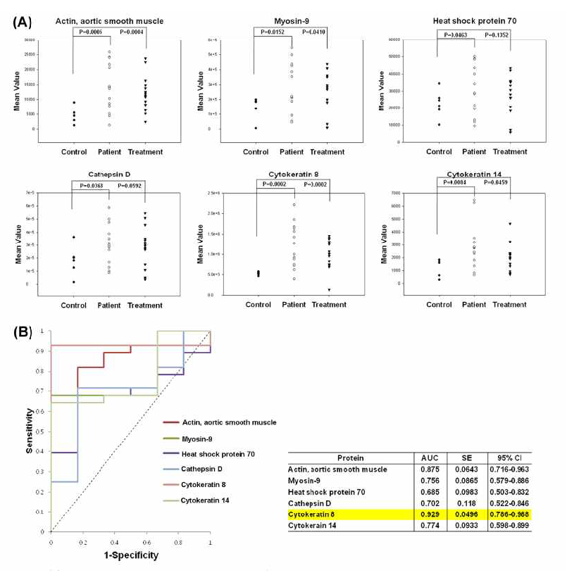 (A) 6개 단백질에 대 한 LC-MRM (x-축, Control, Patient: patient before treatment with ranibizumab, Treatment:: patient 1 month after treatment with ranibizumab; y-축, mean value: corrected value of peak area with internal standard). (B) 6개 단백질의 ROC curves. 6개 단백질 모두 높은 AUC (area under the curve)를 보이며, 특히 cytokeratin8의 AUC는 0.929로 매우 높음