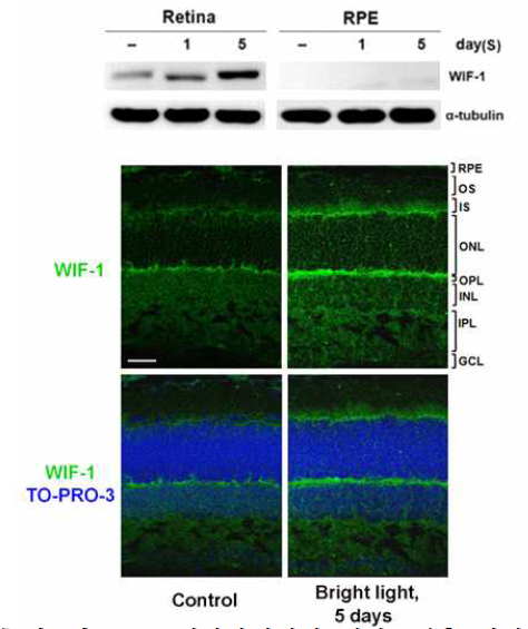 강한 빛 (20,000 lux)에 1시간 조사후 1일, 5일째 안구를 적출하여 Western blot을 시행하고, 5일째 망막 에서 면역형광염색을 시행함