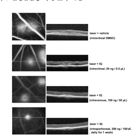 IQ에 의한 맥락막신생혈관 생성 감소와 혈관누출 감소 (in vivo study).