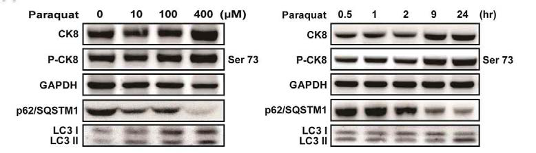 망막상피세포의 산화스트레 스에 따른 autophagy 표적 단백질의 발현 확인 및 CK8 단백질 발현 확