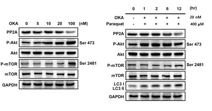 망막색소상피세포에서의 자가포식작용과 AKT/mTOR 신호전달체계 표적 단백질의 발현 확인