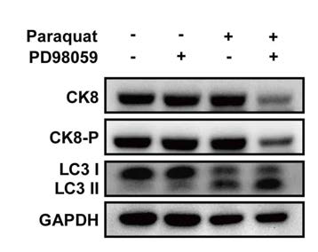 PD98059를 이용한 CK8-P 발현억 제확인