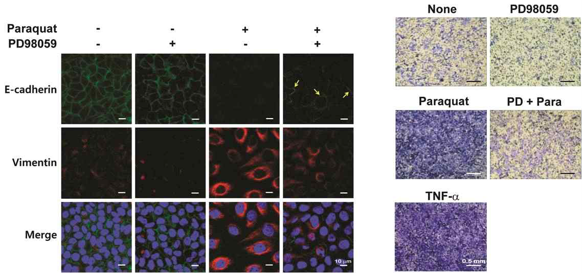 ERK inhibitor인 PD98059를 이용하여 CK-8의 인산화 억제 후 상피-간엽세포 전이 및 세포 이동성 관찰