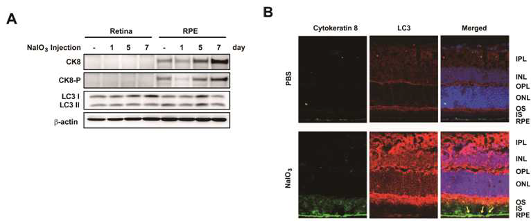 산화스트레스 유발 동물모델 망막조직에서의 자가포식작용 마커 단백질과 Cytokeratin-8의 과발현.