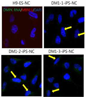 DM1-특이 신경능선 세포에서의 RNA 축척 확인