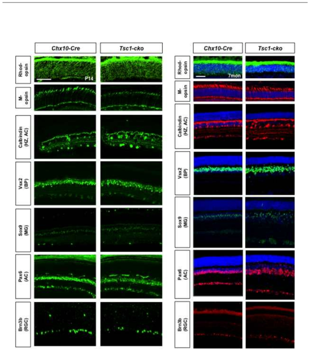 Tsc1-cko 생쥐 망막 신경세포 분포 이상.