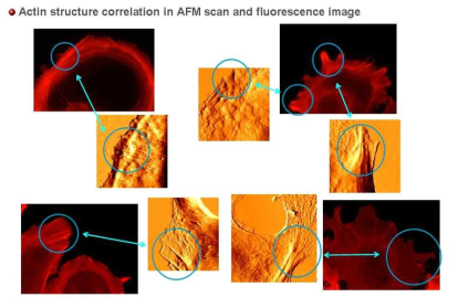 유방암 세포내 액틴 구조(붉은색)와 세포표면의 AFM 이미지(주황색)의 상응함