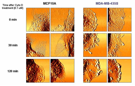 Cytochalasin D 처리 후 시간에 따른 세포경계의 변화 양상