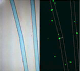 전혈을 이용한 spiking test를 진행하여 분리된 MCF-7의 형광 염색 이미지