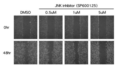427.1.86에서 PRSS14 의 분비를 유도하는 JNK 저해제를 처 리하였을 경우 세포의 이동성 확 인 실험