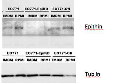C57BL6 생쥐의 동형 세포인 EO771 유방암 세포에서 epithin 단백질 발현 억제 세포주 제작