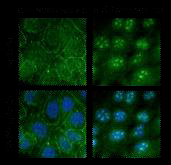 세포외 절편과 세포내 절편의 위치의 염색 양상이 다르다