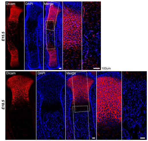 태생기 15.5일과 18.5일의 경골에서 Dicam의 발현 양상을 면역형광염색으 로 확인함.
