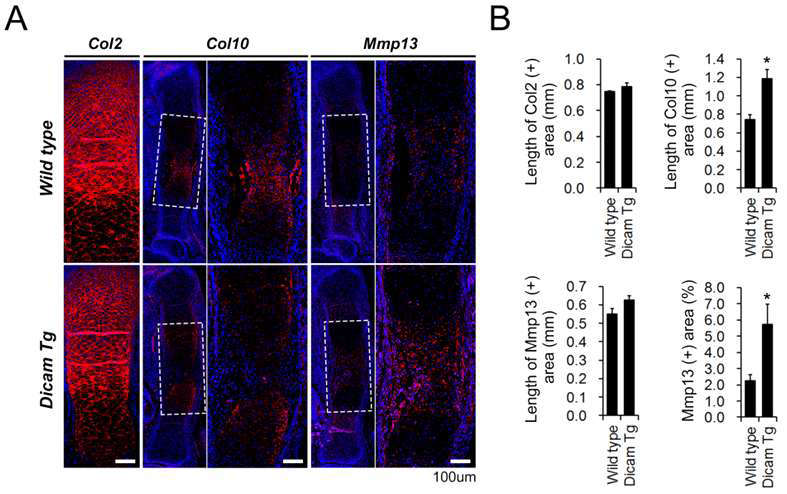 태생기 15.5일의 Wild type과 Col2-Dicam Tg의 Tibia에서 제 2형 콜라겐, 제 10형 콜라겐 및 MMP13의 발현을 면역형광염색으로 확인하고 각각의 발현 정도를 정량화 함.