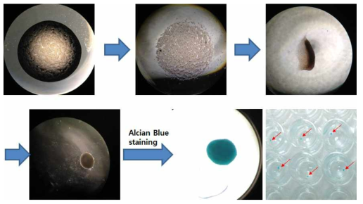 Adipose derived stem cell 의 chondrocyte 로의 분화 과정
