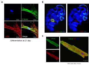 (A) 분화가 완료된 심근세포에 X factor와 심근세포 표지 인자 α-sarcomeric actin을 염색한 모습. (B) 12.5일째의 설치류 배아에서 X factor와 심근세포 표지인자 α-sarcomeric actin을 염 색한 모습. (C) 설치류 성체의 심근세포에 X factor와 심근세포 표 지인자 cTnT를 염색한 모습.