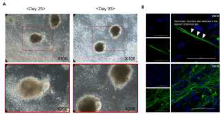 (A) 인간의 배아줄기세포로부터 배아체(Embryoid body)형성법 을 통해 자율박동세포를 얻었음. (B) 자율박동세포를 cardiac troponin T(cTnT)로 표지.