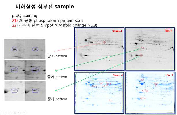 비허혈성 말기 심부전 시료의 인산화 단백체 분석 대표 이미지 및 증,감 현상을 보이는 단백질 스팟들의 예시