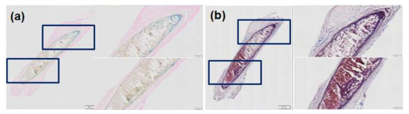 면역염색 (a: 철염색, b: Masson trichrome 염색