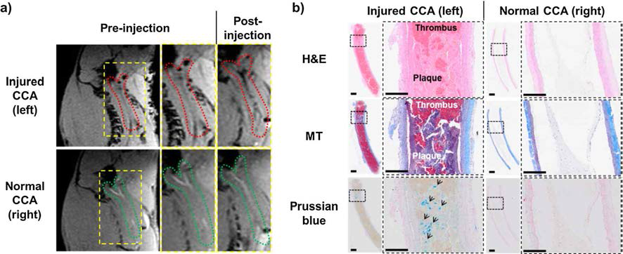 Rat artery balloon injury model 의 동물 MR 영상과 총경동맥(common carotid artery 해부분석