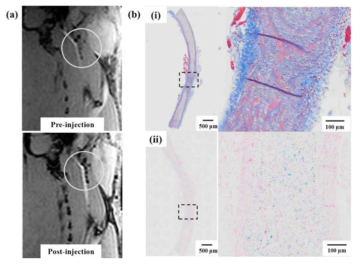 (a) Rat artery balloon injury model 의 동물 MR 영상과 (b) 총경동맥(common carotid artery) 해부분석