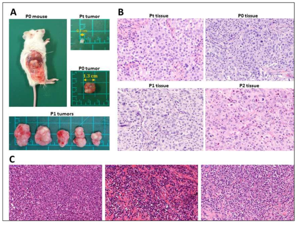 of patient-derived tumor xenograft mouse model for lung cancer.