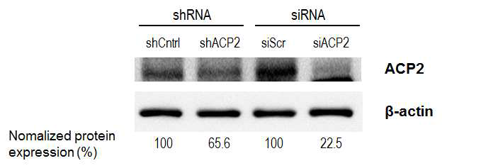 ACP2를 타겟팅하는 shRNA와 siRNA로 인한 세포 내 ACP2의 발현 변화.
