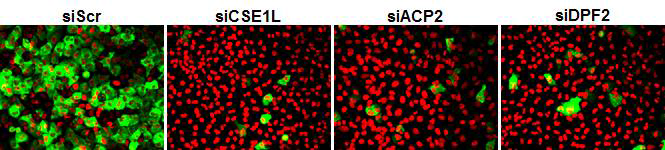 검증된 siACP2와 siDPF2에 의한 형광-인플루엔자 바이러스의 감염억제