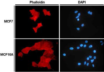 actin expression in MCF7 and 10A on the coverslip