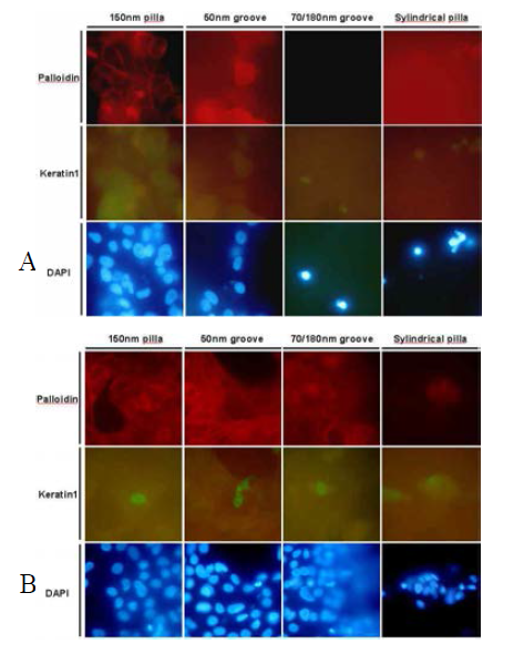 The expression of actin and keratin1 in MCF7 (A) & MCF10A (B)on the pattern