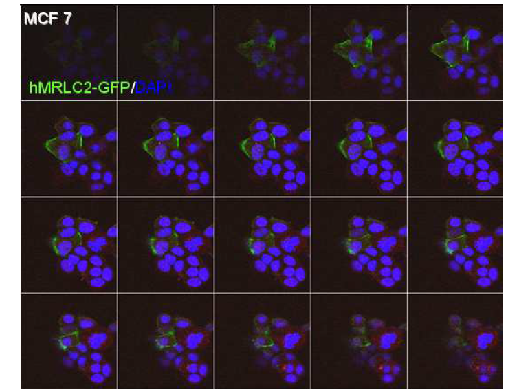 The serial expression of hMRLC2-GFP in MCF7 cells