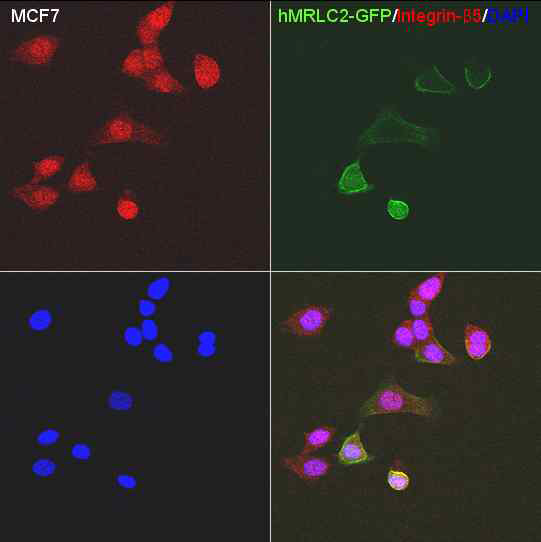 The expression of hMRLC2-GFP and integrin-β5 in MCF7.