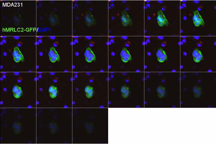 The serial expression of hMRLC2-GFP in MDA231 cells