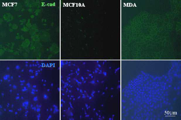 The expression of E-cadherin in various cancer cells