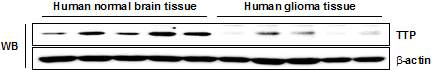 신경교종 세포주 및 사람 뇌조직 에서 TTP 발현