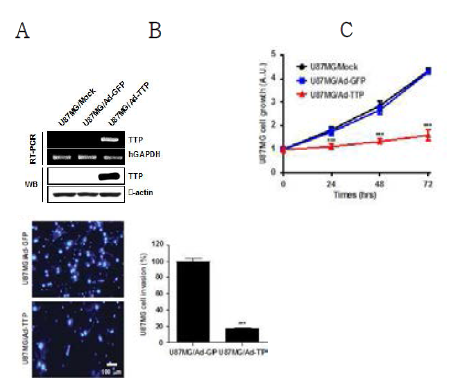 TTP에 의한 신경교종 세포주 성장 및 전이 억제